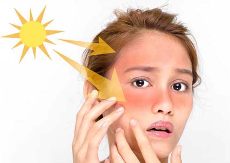 انواع روشهای برنزه شدن (بدون ضرر) 3 برنزه شدن پوست با آفتاب